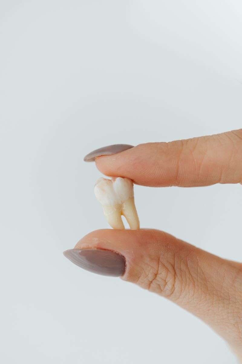 Tooth Extraction