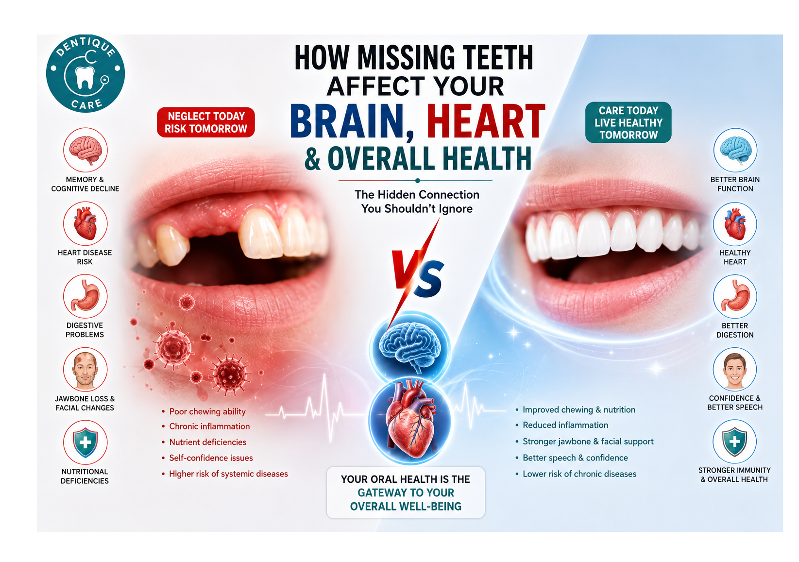 Can Missing Teeth Affect Your Brain, Heart and Overall Health? The Hidden Health Risks of Tooth Loss
