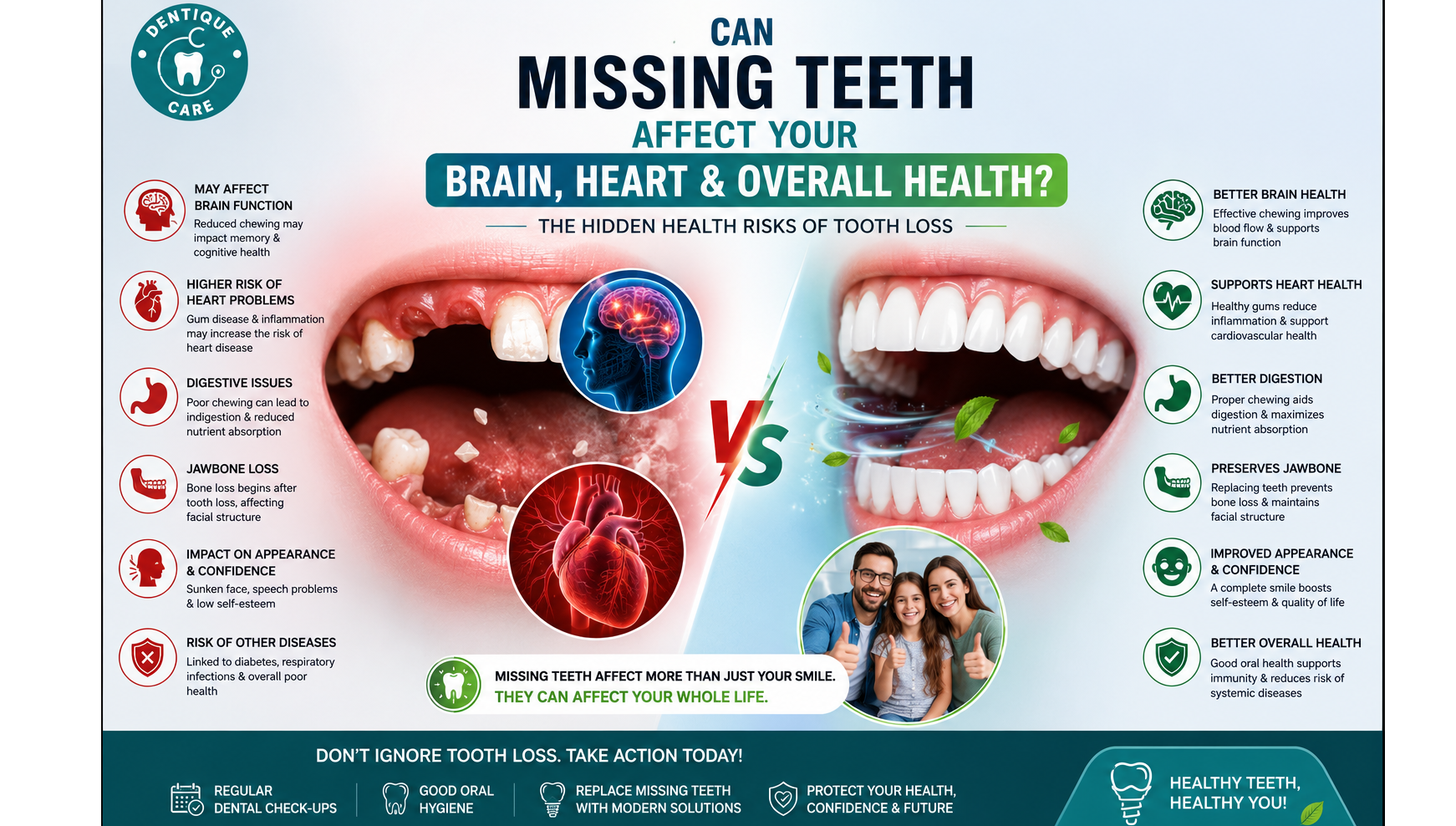 Can Missing Teeth Affect Your Brain, Heart and Overall Health? The Hidden Health Risks of Tooth Loss