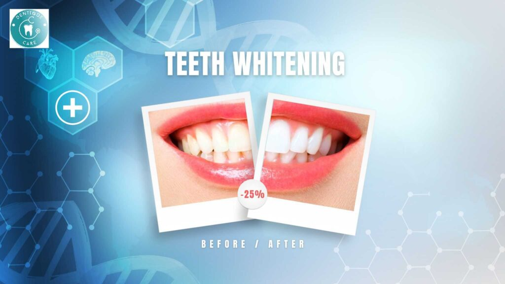 How to Whiten Your Teeth Naturally at Home
