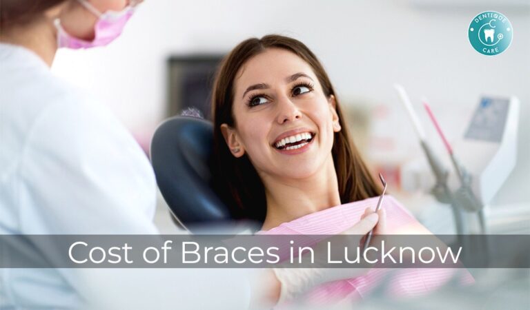 Read more about the article Cost of Braces in Lucknow