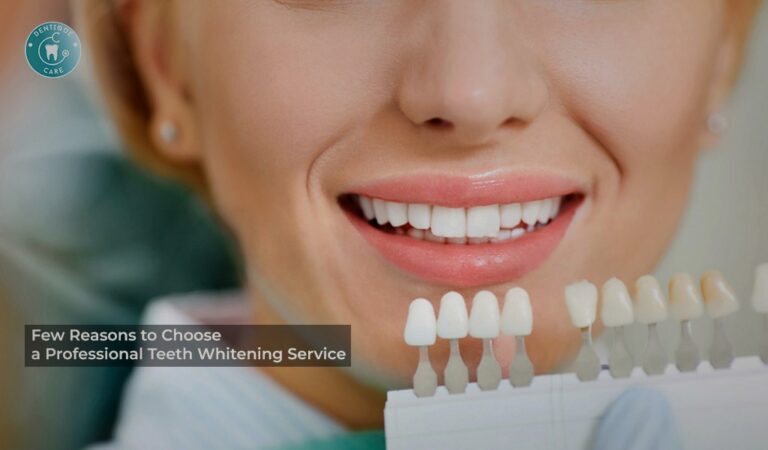 Read more about the article Few Reasons to Choose a Professional Teeth Whitening Service
