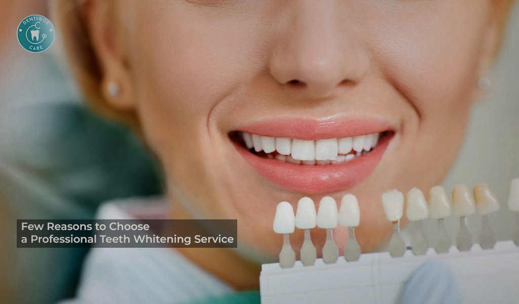 You are currently viewing Few Reasons to Choose a Professional Teeth Whitening Service