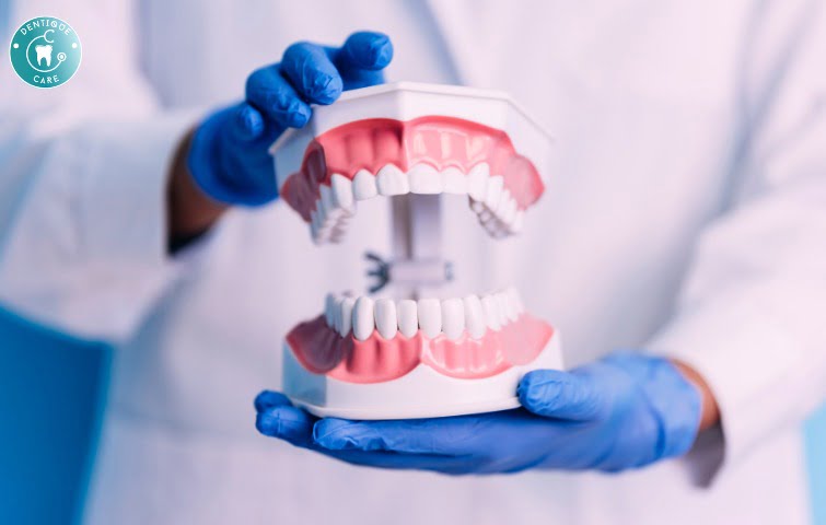 Read more about the article Getting Dental Implants: What to Expect?