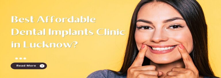 Read more about the article Best Affordable Dental Implants Clinic in Lucknow?