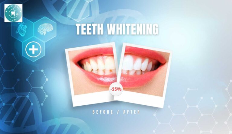 Read more about the article How to Whiten Your Teeth Naturally at Home