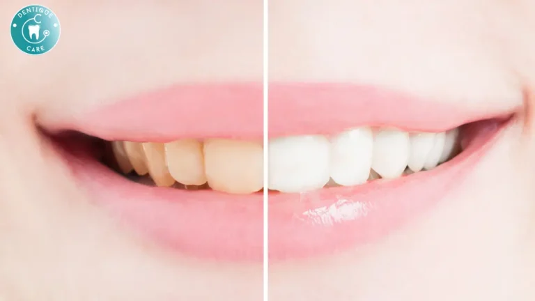 Read more about the article How to Instantly Whiten Teeth at Home: 5 Quick Hacks You Can Try Today